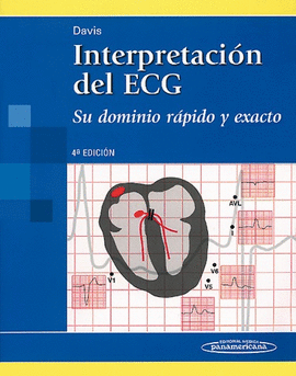 INTERPRETACION DEL ECG 4 ED